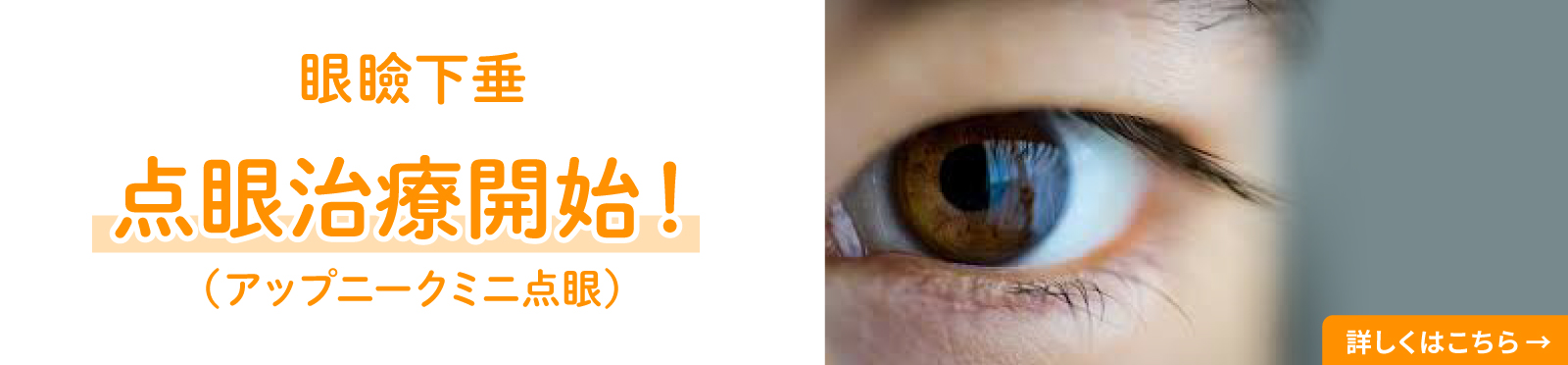 眼瞼下垂 点眼治療開始!(アップニークミニ点眼)